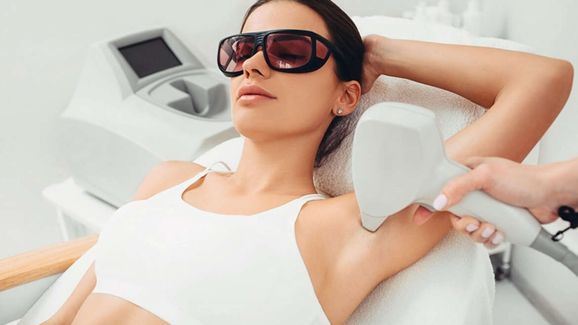 Unwanted Laser Hair Removal